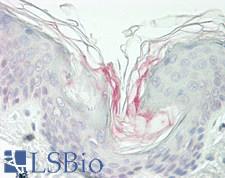 NKG2DL4 / ULBP4 Antibody - Human Skin: Formalin-Fixed, Paraffin-Embedded (FFPE)