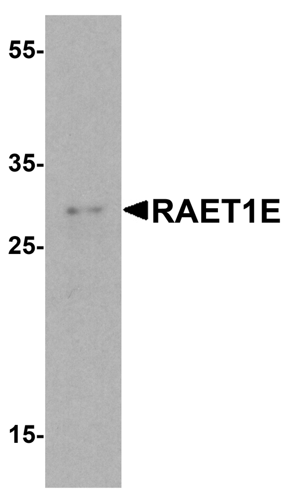 NKG2DL4 / ULBP4 Antibody - Western blot analysis of RAET1E in EL4 cell lysate with RAET1E antibody at 1 ug/ml.