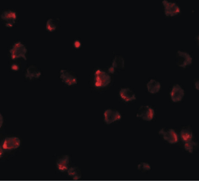 NKX2-4 Antibody - Immunofluorescence of NKX2-4 in A20 cells with NKX2-4 antibody at 20 ug/ml.