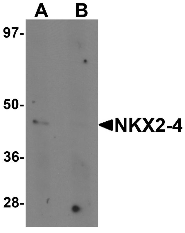 NKX2-4 Antibody - Western blot analysis of NKX2-4 in A20 cell lysate with NKX2-4 antibody at 1 ug/ml in (A) the absence and (B) the presence of blocking peptide.