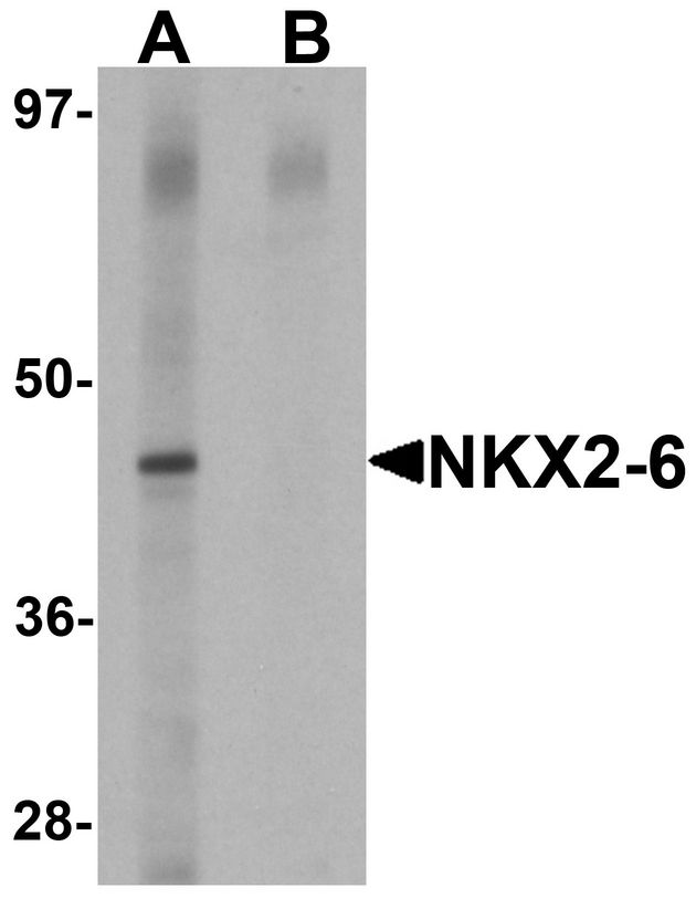 NKX2-6 Antibody - Western blot analysis of NKX2-6 in mouse heart tissue lysate with NKX2-6 antibody at 1 ug/ml in (A) the absence and (B) the presence of blocking peptide.