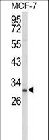 NKX3-1 Antibody - Western blot of NKX3-1 Antibody in MCF-7 cell line lysates (35 ug/lane). NKX3-1 (arrow) was detected using the purified antibody.