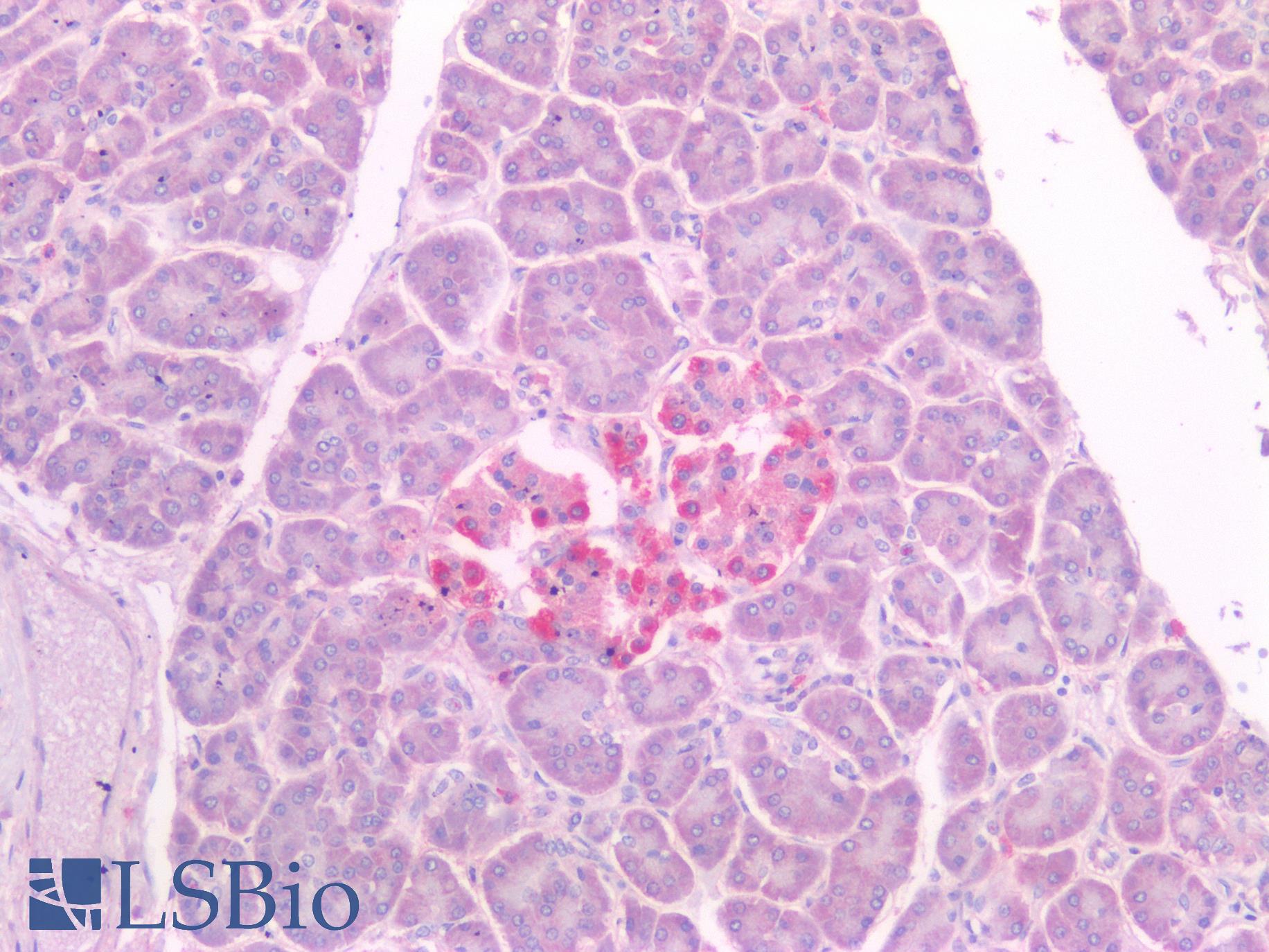 NKX6-1 Antibody - Human Pancreas, Islets of Langerhans: Formalin-Fixed, Paraffin-Embedded (FFPE)