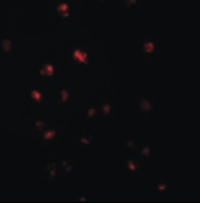 NLRC5 / NOD4 Antibody - Immunofluorescence of NOD4 in HeLa cells with NOD4 antibody at 20 ug/ml.