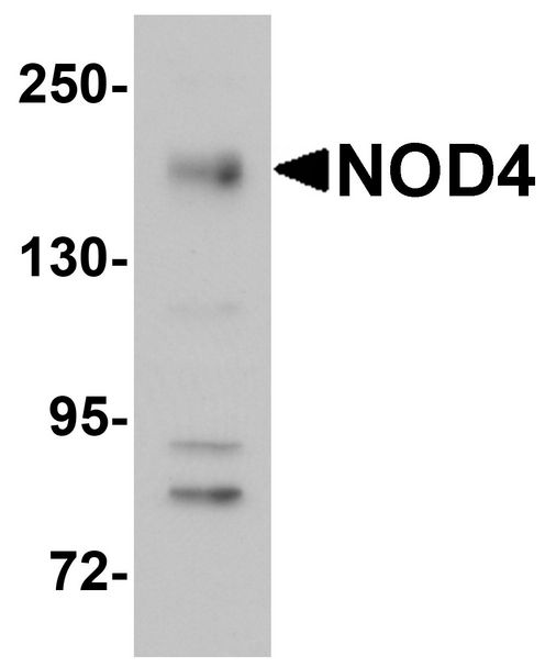 NLRC5 / NOD4 Antibody - Western blot analysis of NOD4 in EL4 cell lysate with NOD4 antibody at 1 ug/ml.