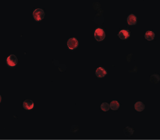 NLRP11 Antibody - Immunofluorescence of NALP11 in HeLa cells with NALP11 antibody at 20 ug/ml.