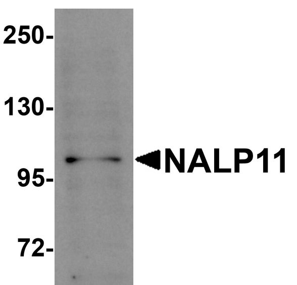 NLRP11 Antibody - Western blot analysis of NALP11 in HeLa cell lysate with NALP11 antibody at 1 ug/ml.