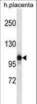 NLRP12 Antibody - NLRP12 Antibody western blot of human placenta tissue lysates (35 ug/lane). The NLRP12 antibody detected the NLRP12 protein (arrow).