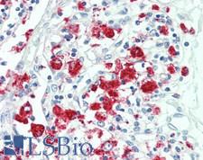 NLRP12 Antibody - Human Thymus: Formalin-Fixed, Paraffin-Embedded (FFPE)