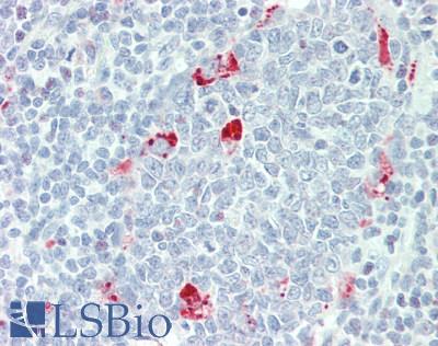 NLRP12 Antibody - Human Tonsil: Formalin-Fixed, Paraffin-Embedded (FFPE)