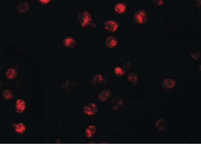 NLRP13 Antibody - Immunofluorescence of NALP13 in K562 cells with NALP13 antibody at 20 ug/ml.