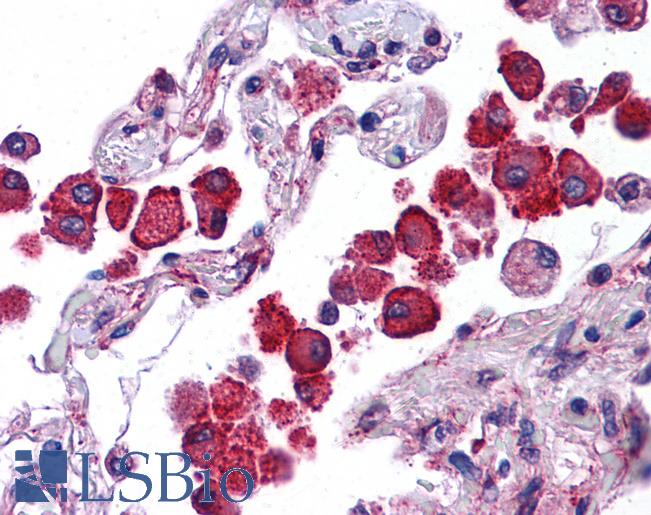 NLRP13 Antibody - Anti-NLRP13 antibody IHC of human lung. Immunohistochemistry of formalin-fixed, paraffin-embedded tissue after heat-induced antigen retrieval. Antibody concentration 5 ug/ml.