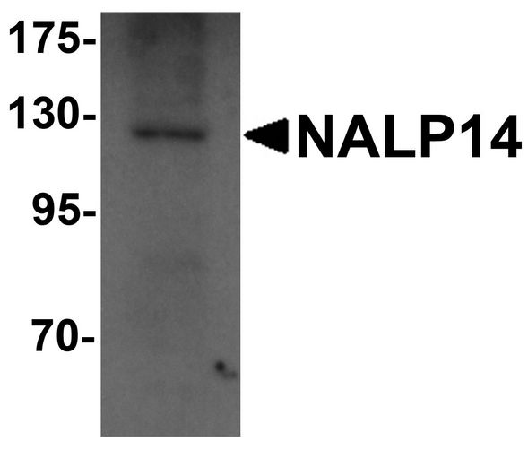 NLRP14 / NALP14 Antibody - Western blot analysis of NALP14 in rat brain tissue lysate with NALP14 antibody at 1 ug/ml.