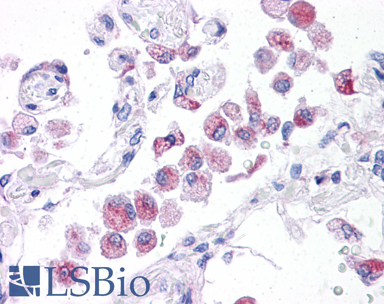 NLRP14 / NALP14 Antibody - Anti-NLRP14 antibody IHC of human lung. Immunohistochemistry of formalin-fixed, paraffin-embedded tissue after heat-induced antigen retrieval. Antibody concentration 5 ug/ml.