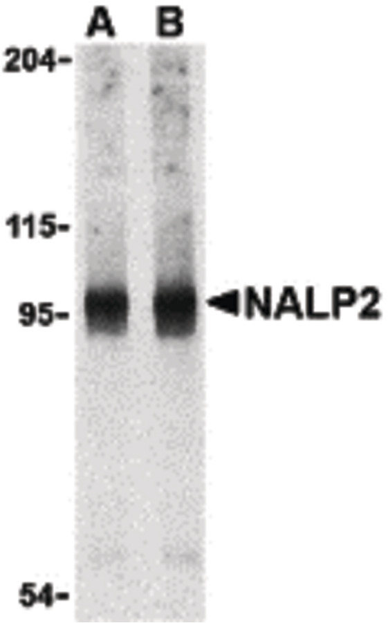 NLRP2 / NALP2 Antibody - Western blot of NALP2 in PC-3 cell lysate with NALP2 antibody at (A) 1 and (B) 2 ug/ml.