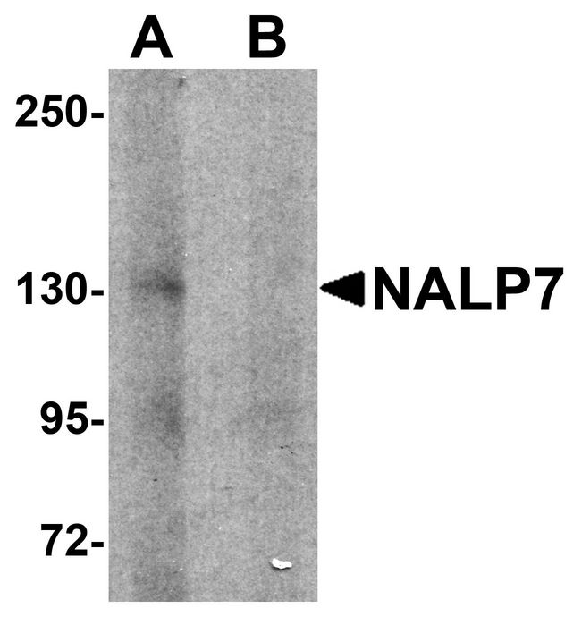 NLRP7 / NALP7 Antibody - Western blot analysis of NALP7 in human brain tissue lysate with NALP7 antibody at 1 ug/ml in (A) the absence and (B) the presence of blocking peptide.