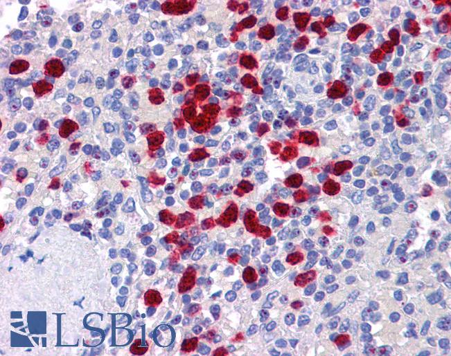 NLRP7 / NALP7 Antibody - Anti-NLRP7 antibody IHC of human spleen. Immunohistochemistry of formalin-fixed, paraffin-embedded tissue after heat-induced antigen retrieval. Antibody concentration 5 ug/ml.