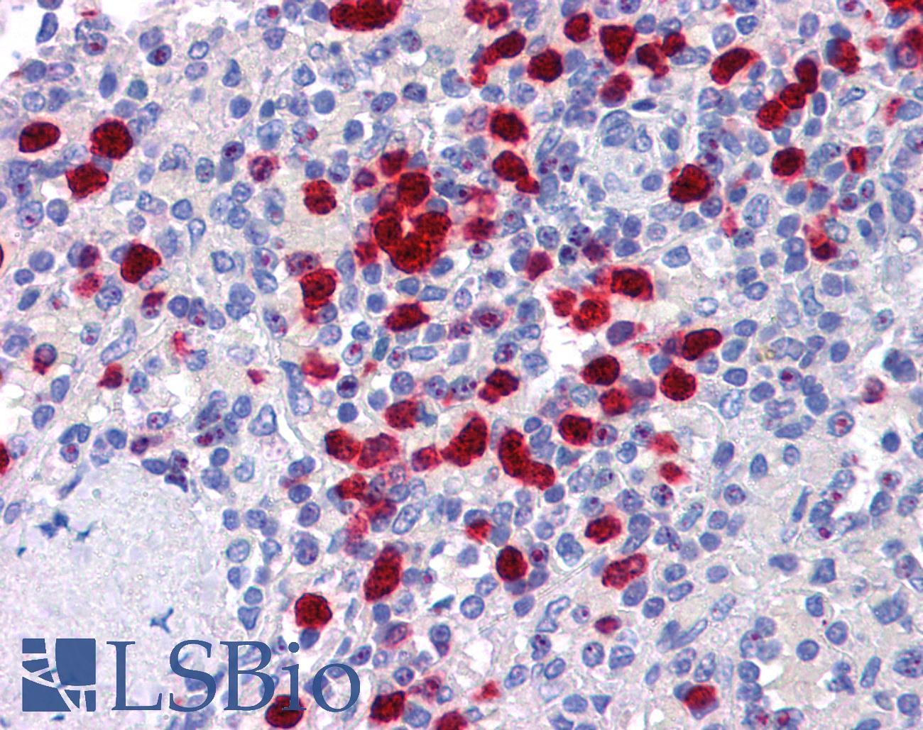 NLRP7 / NALP7 Antibody - Anti-NLRP7 antibody IHC of human spleen. Immunohistochemistry of formalin-fixed, paraffin-embedded tissue after heat-induced antigen retrieval. Antibody concentration 5 ug/ml.