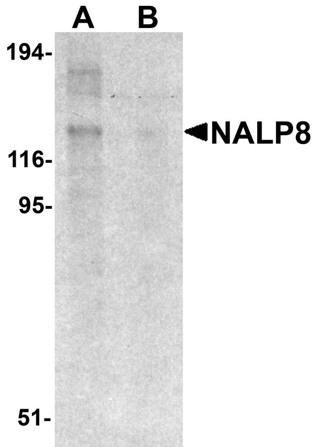 NLRP8 Antibody - Western blot analysis of NALP8 in human colon tissue lysate with NALP8 antibody at 1 ug/ml in (A) the absence and (B) the presence of blocking peptide.