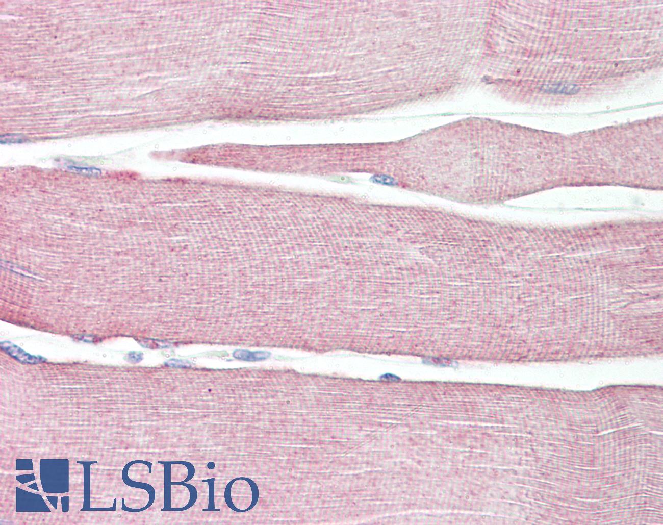 NLRX1 Antibody - Anti-NLRX1 antibody IHC of human skeletal muscle. Immunohistochemistry of formalin-fixed, paraffin-embedded tissue after heat-induced antigen retrieval. Antibody dilution 5-10 ug/ml.