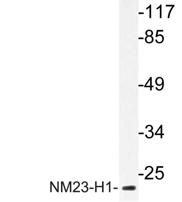 NME1 / NM23 Antibody - Western blot analysis of lysate from HeLa cells, uising NM23-H1 antibody.