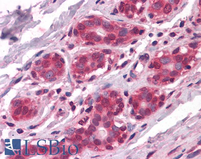 NME1 / NM23 Antibody - Anti-NME1 antibody IHC of human breast. Immunohistochemistry of formalin-fixed, paraffin-embedded tissue after heat-induced antigen retrieval. Antibody dilution 1:200.