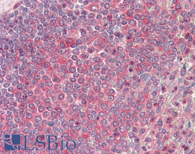NME2 Antibody - Anti-NME2 / NM23 antibody IHC staining of human spleen. Immunohistochemistry of formalin-fixed, paraffin-embedded tissue after heat-induced antigen retrieval. Antibody dilution 1:100.