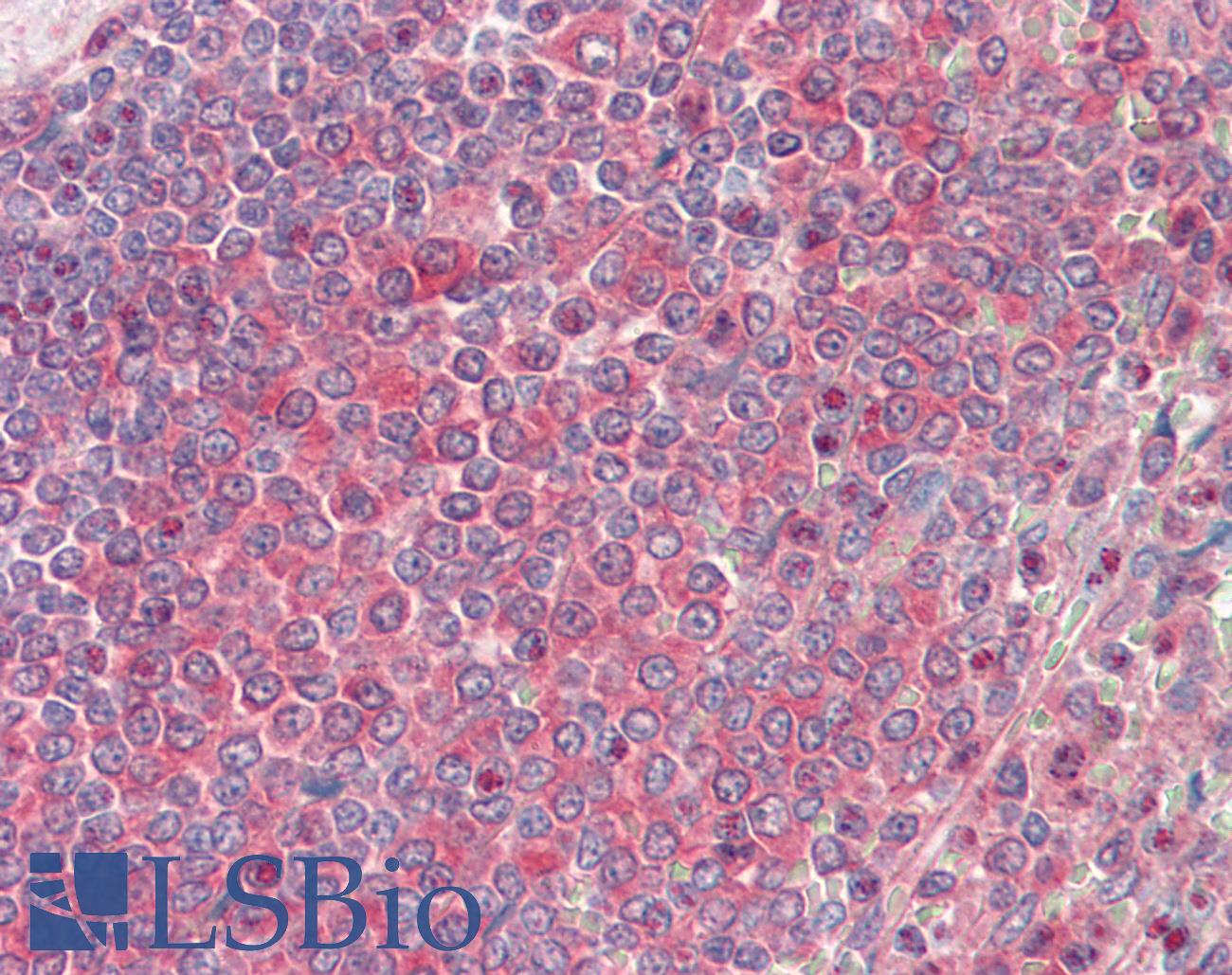 NME2 Antibody - Anti-NME2 / NM23 antibody IHC staining of human spleen. Immunohistochemistry of formalin-fixed, paraffin-embedded tissue after heat-induced antigen retrieval. Antibody dilution 1:100.