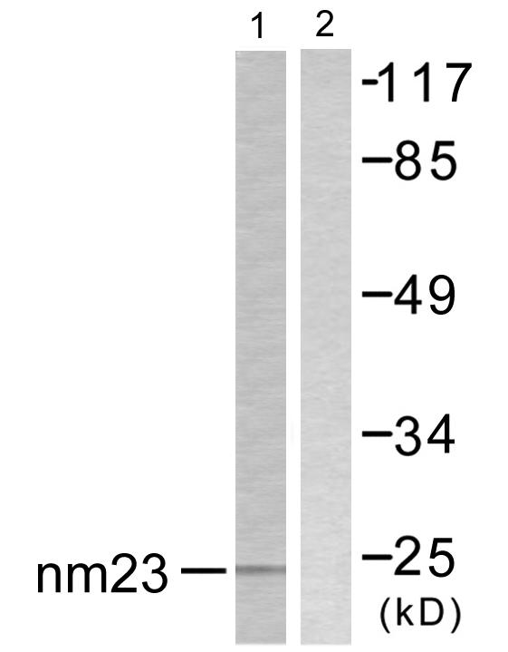 NME2 Antibody - Western blot analysis of lysates from K562 cells, using NM23 Antibody. The lane on the right is blocked with the synthesized peptide.