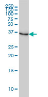 NMI Antibody - NMI monoclonal antibody (M01), clone 9D8 Western blot of NMI expression in HeLa.