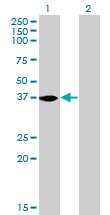 NMI Antibody - Western blot of NMI expression in transfected 293T cell line by NMI monoclonal antibody (M01), clone 9D8.