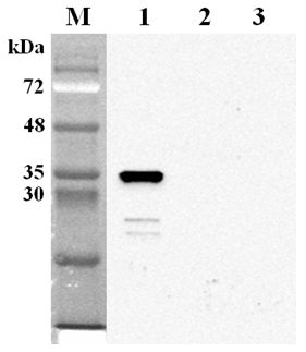 NMNAT2 Antibody - Western blot analysis using anti-NMNAT2 (human), mAb (Nady-1) at 1:2000 dilution. 1: Human NMNAT2 (His-tagged). 2: Human NMNAT3 (His-tagged). 3: Unrelated (His-tagged) (negative control).