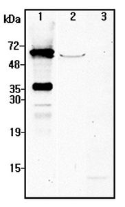 NMNAT2 Antibody - Western blot analysis using anti-NMNAT2 (human), pAb at 1:4000 dilution. 1: Human NMNAT2 (His-tagged) (50ng). 2: Human mesenchymal stem cell lysate (V1T1) (50 ug). 3: Unrelated Protein (His-tagged) (50ng).
