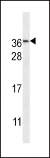 NMNAT3 Antibody - NMNAT3 Antibody western blot of NCI-H460 cell line lysates (35 ug/lane). The NMNAT3 antibody detected the NMNAT3 protein (arrow).