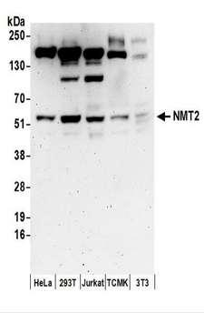 NMT2 Antibody - Detection of Human and Mouse NMT2 by Western Blot. Samples: Whole cell lysate (50 ug) prepared using NETN buffer from HeLa, 293T, Jurkat, mouse TCMK-1, and mouse NIH3T3 cells. Antibodies: Affinity purified rabbit anti-NMT2 antibody used for WB at 0.1 ug/ml. Detection: Chemiluminescence with an exposure time of 3 minutes.