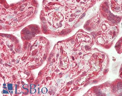 NMT2 Antibody - Human Placenta: Formalin-Fixed, Paraffin-Embedded (FFPE)