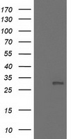 NNMT Antibody - HEK293T cells were transfected with the pCMV6-ENTRY control (Left lane) or pCMV6-ENTRY NNMT (Right lane) cDNA for 48 hrs and lysed. Equivalent amounts of cell lysates (5 ug per lane) were separated by SDS-PAGE and immunoblotted with anti-NNMT.