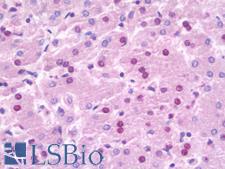 NOC3L Antibody - Anti-NOC3L antibody IHC staining of human liver. Immunohistochemistry of formalin-fixed, paraffin-embedded tissue after heat-induced antigen retrieval. Antibody dilution 1:50.