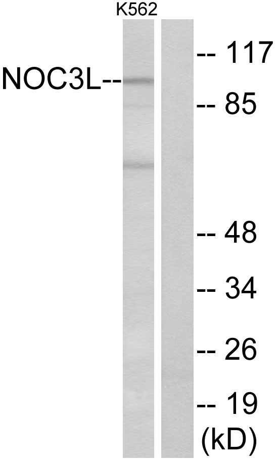 NOC3L Antibody - Western blot analysis of lysates from K562 cells, using NOC3L Antibody. The lane on the right is blocked with the synthesized peptide.
