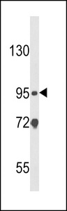 NOD1 Antibody - Western blot of CARD4 Antibody in HL-60 cell line lysates (35 ug/lane). CARD4 (arrow) was detected using the purified antibody.