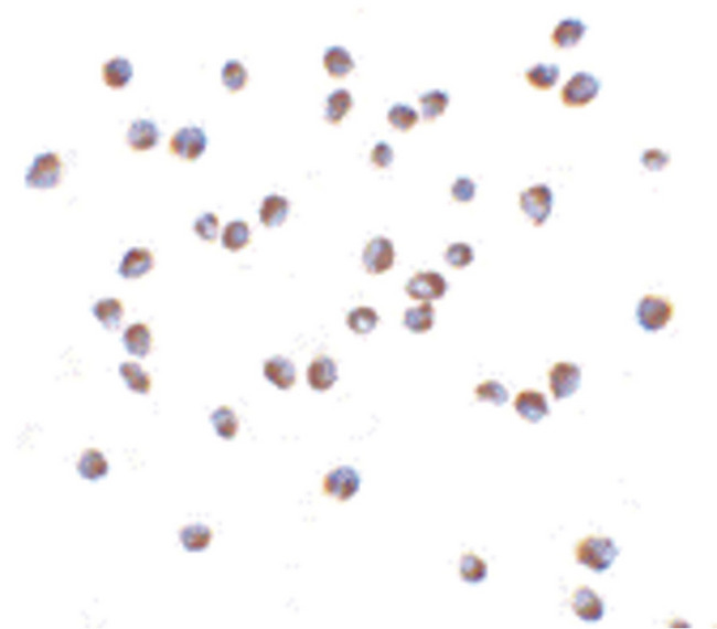 NOD2 / CARD15 Antibody - Immunocytochemistry of NOD2 in Jurkat cells with NOD2 antibody at 5 ug/ml.