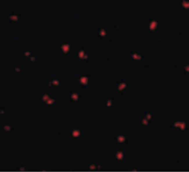 NOD2 / CARD15 Antibody - Immunofluorescence of NOD2 in Jurkat cells with NOD2 antibody at 20 ug/ml.
