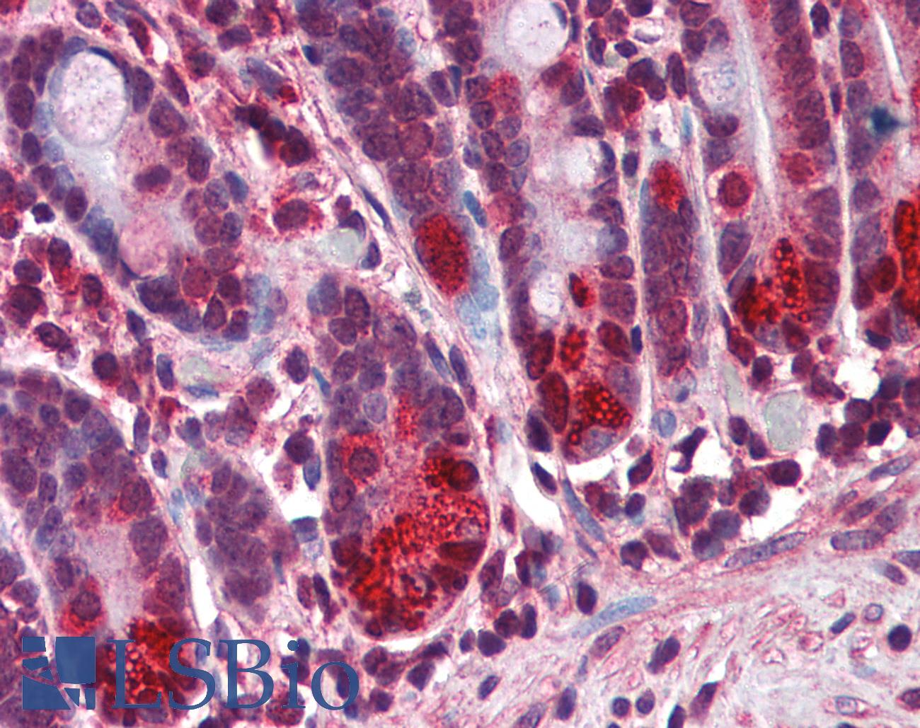 NOD2 / CARD15 Antibody - Anti-NOD2 antibody IHC of human small intestine. Immunohistochemistry of formalin-fixed, paraffin-embedded tissue after heat-induced antigen retrieval. Antibody concentration 3 ug/ml.