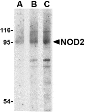 NOD2 / CARD15 Antibody - Western blot of NOD2 in Jurkat cell lysate with NOD2 antibody at (A) 1, (B) 2 and (C) 4 ug/ml.