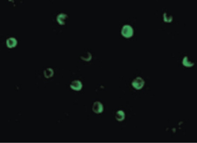 NOD2 / CARD15 Antibody - Immunofluorescence of NOD2 in HeLa cells with NOD2 antibody at 20 ug/ml.