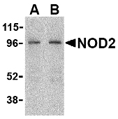 NOD2 / CARD15 Antibody - Western blot of NOD2 in HeLa cell lysate with NOD2 antibody at (A) 2 and (B) 4 ug/ml.