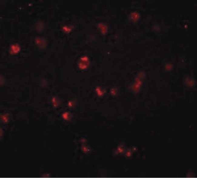 NOD3 / NLRC3 Antibody - Immunofluorescence of NOD3 in Jurkat cells with NOD3 antibody at 20 ug/ml.