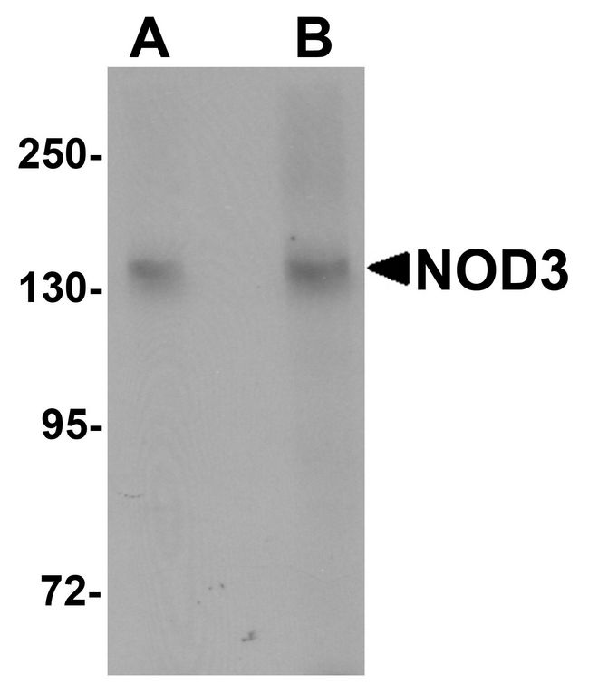 NOD3 / NLRC3 Antibody - Western blot analysis of NOD3 in 3T3 cell lysate with NOD3 antibody at (A) 1 and (B) 2 ug/ml.