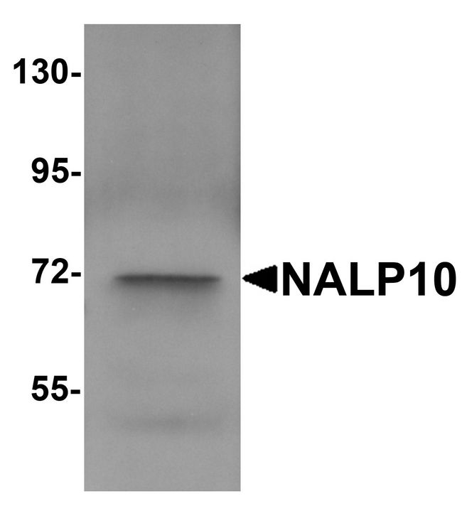 NOD8 / NLRP10 Antibody - Western blot analysis of NALP10 in human brain tissue lysate with NALP10 antibody at 1 ug/ml.