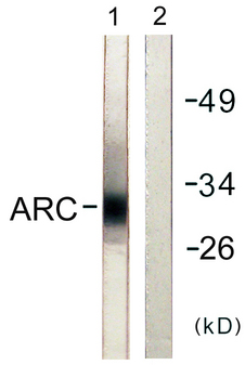 NOL3 / ARC Antibody - Western blot analysis of lysates from HeLa cells, using ARC Antibody. The lane on the right is blocked with the synthesized peptide.